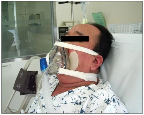 Ventilação Não Invasiva -MedNobel