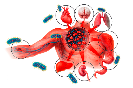 sepse na emergência